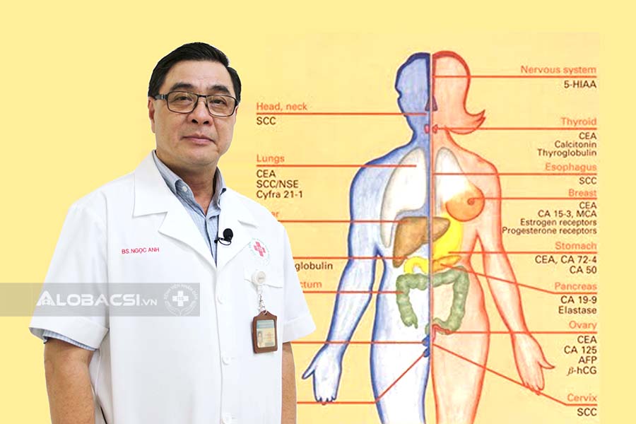 BS.CK2 Nguyễn Ngọc Anh: Nên làm gì khi kết quả xét nghiệm marker ung thư tăng?