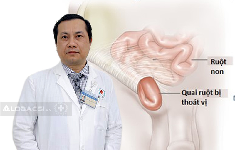 ThS.BS Trần Thanh Phong: Phẫu thuật thoát vị bẹn như thế nào?