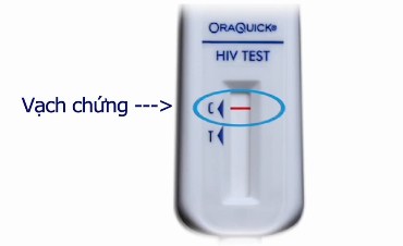 Hướng dẫn từng bước tự xét nghiệm HIV tại nhà